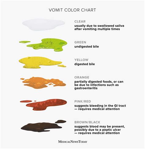 vomit color chart child.